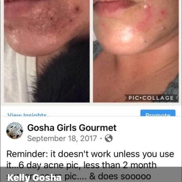 SUNDAY PM SALE!!❤️🩹MIRACLE HEALING BALM ❤️🛍🤗⭐️—BEST IN BEAUTY PICK!! 👌 - Picture 12 of 16